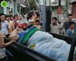 Dirawat di RSUD, Fajri Pria Berbobot 300 Kg Asal Tangerang Keluhkan Nyeri Kaki